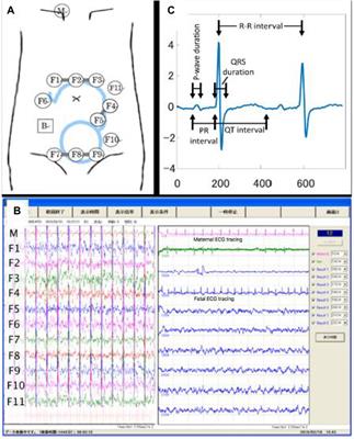 A deep learning framework for noninvasive fetal ECG signal extraction